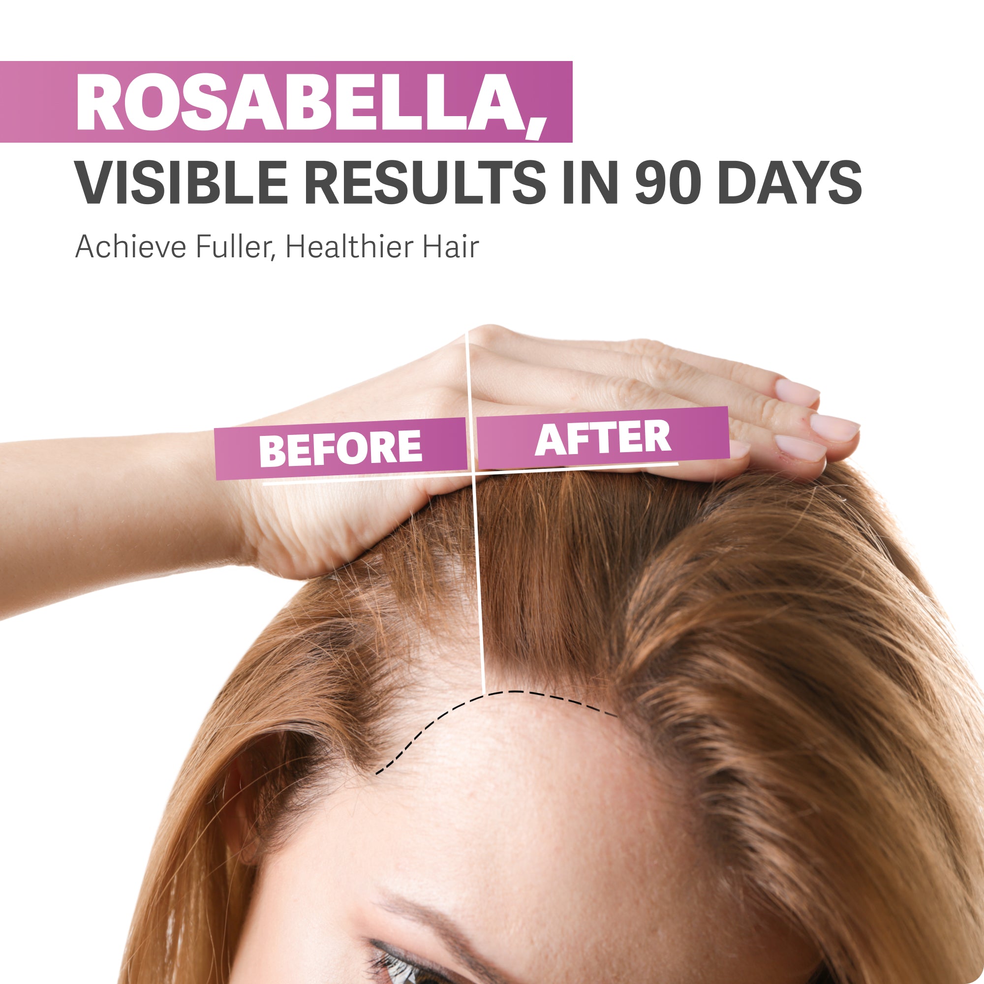 Rosabella Biotin Gummies (5000mg) for Hair, Skin & Nails Growth BOGO+